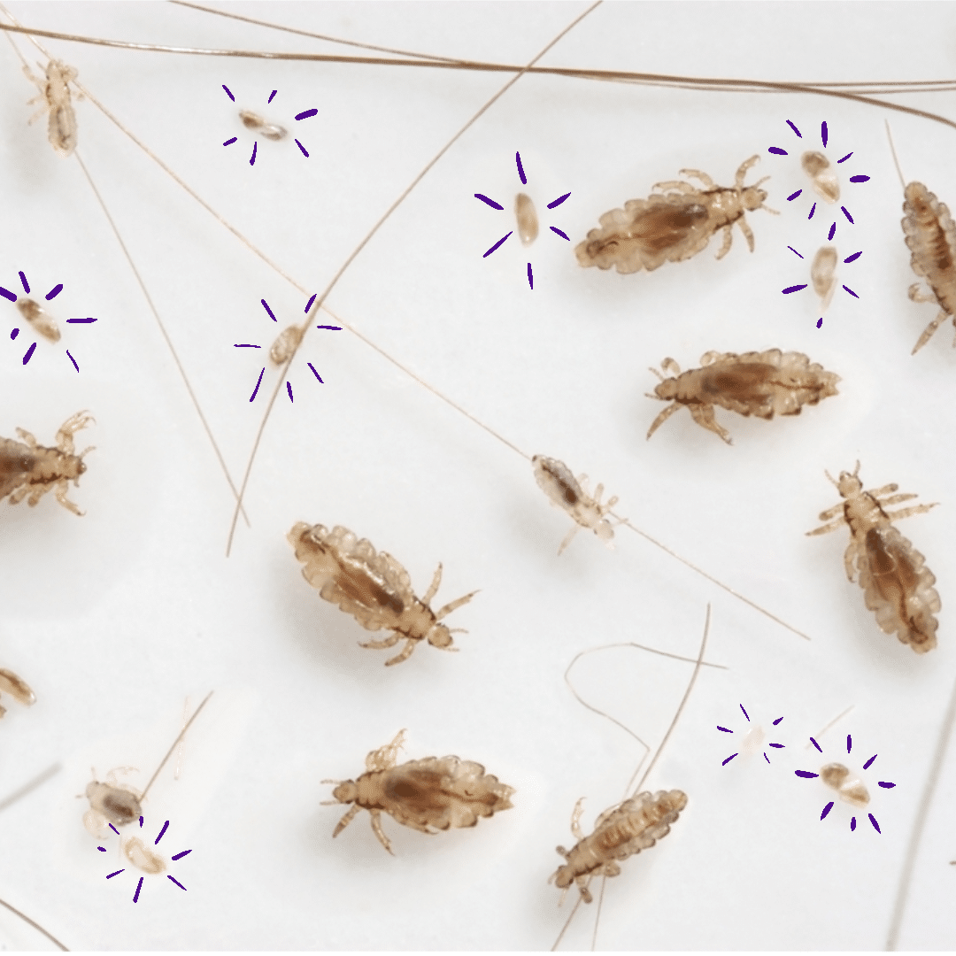 Do Lice Eggs Pop? – Licefreee