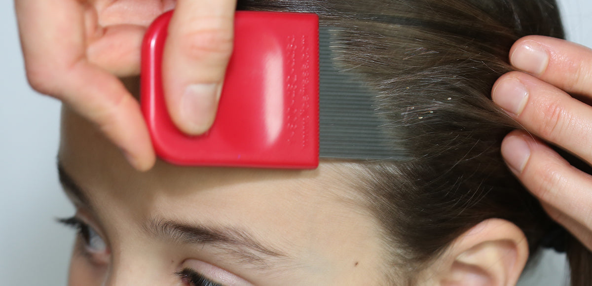 Nits Color Profile How Do You Know It’s Nits? – Licefreee