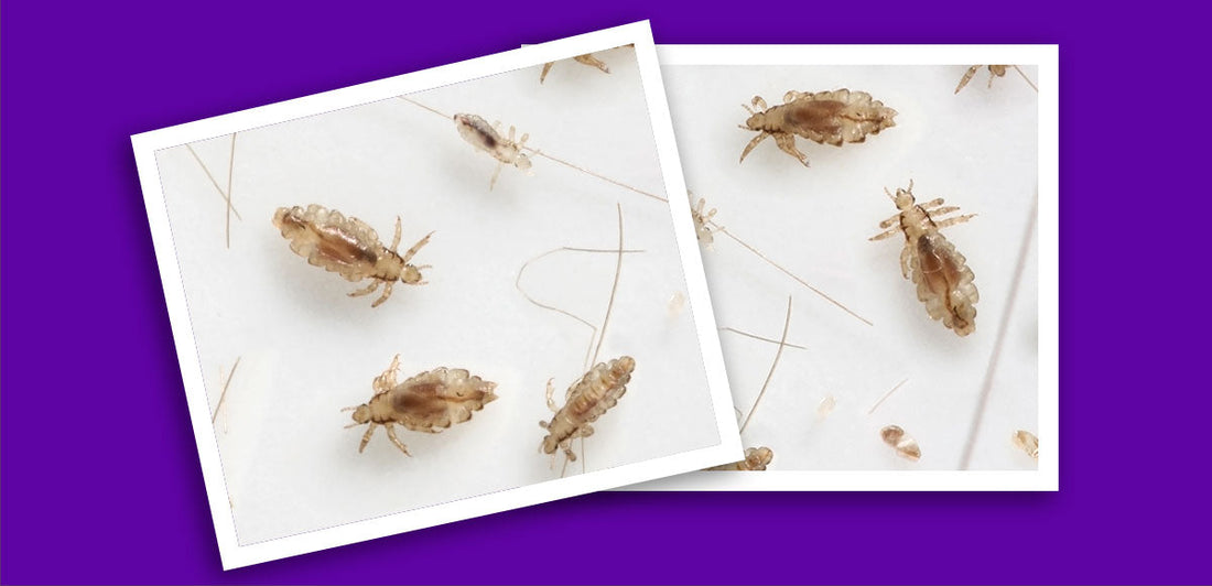 What Is Another Name for Head Lice? – Licefreee