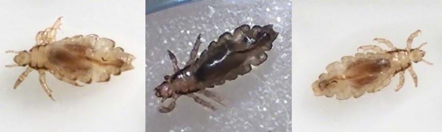 Pictures of Head Lice | Licefreee