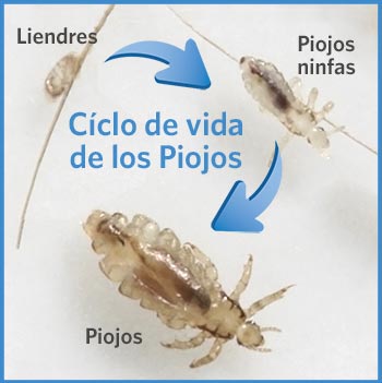 Lice Cycle infographic